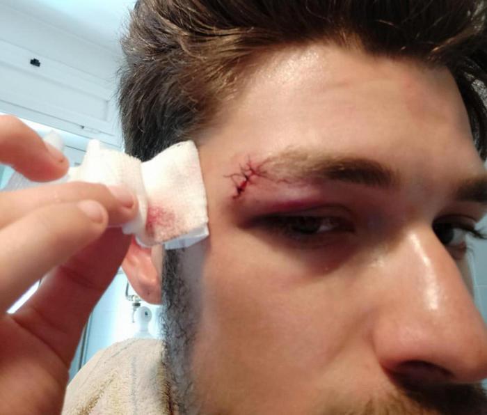 identificati quattro aggressori