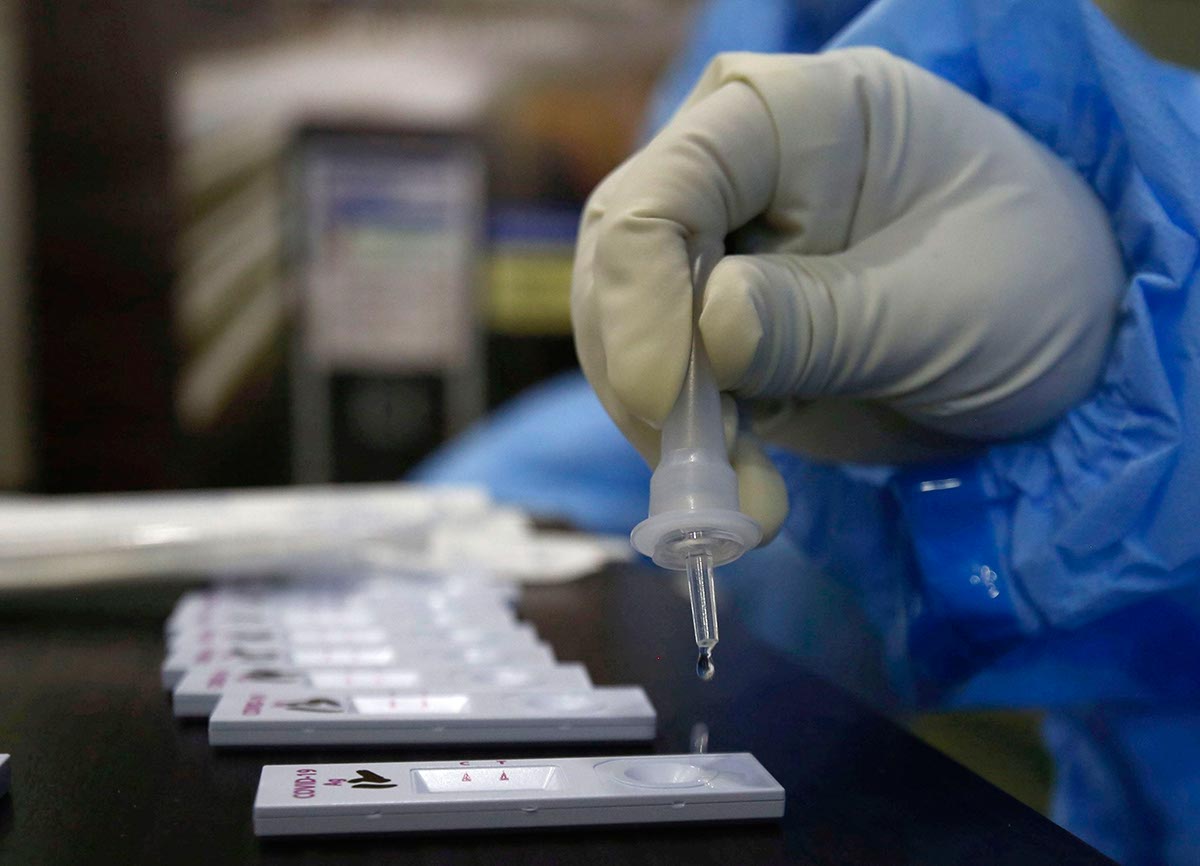 contagi coronavirus covid