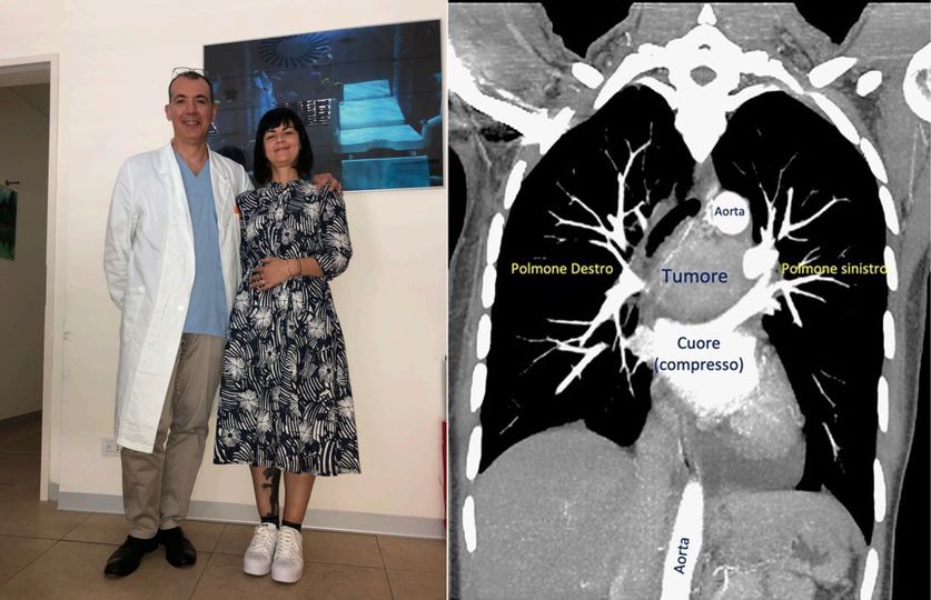 tumore borgo trento dott Infante