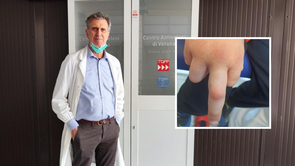 Il dott. Giorgio Ricci all'ingresso del Centro Antiveleni e il dito del bambino morso dalla vipera