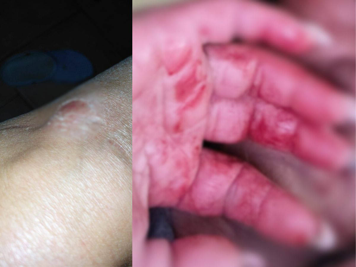 Donna aggredita Bovolone