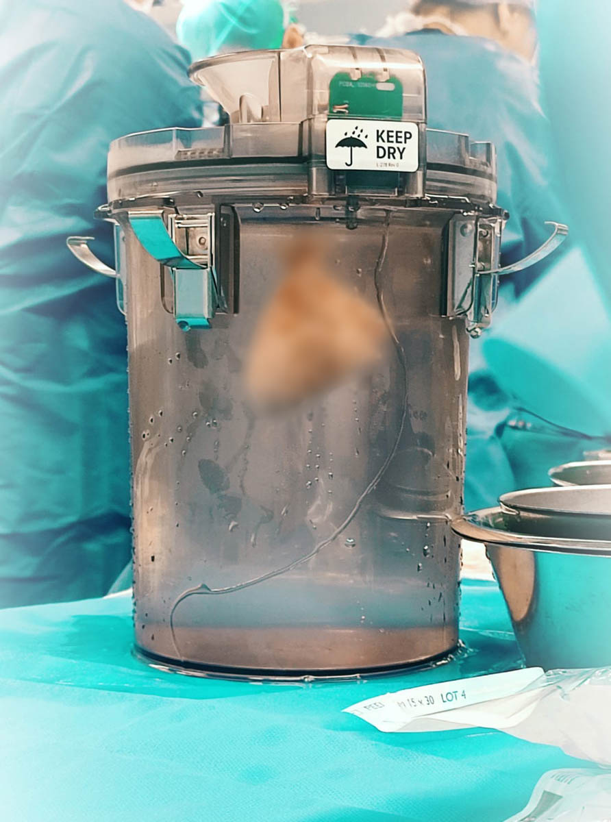 Piccolo cuore nel contenitore per il trasporto degli organi